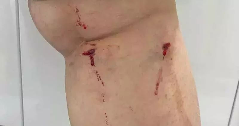 YTÜ den kampüsteki köpek saldırısıyla ilgili açıklama