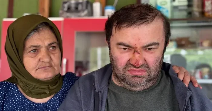 Yer: Bolu... Korkunç olay: Yüzde 90 engelli adama öldüresiye dayak!