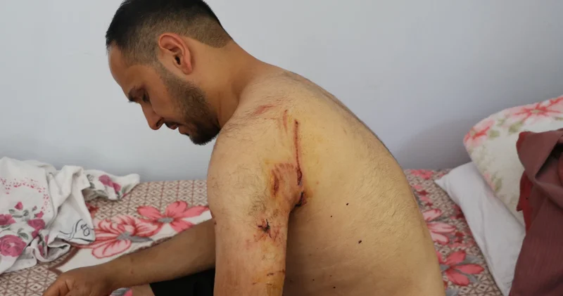 Kayseri de köpek dehşeti! Karı koca yaralandı