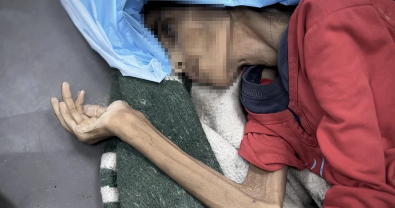 Gazze de özel gereksinimli bir kadın açlık ve yetersiz beslenme sonucu hayatını kaybetti