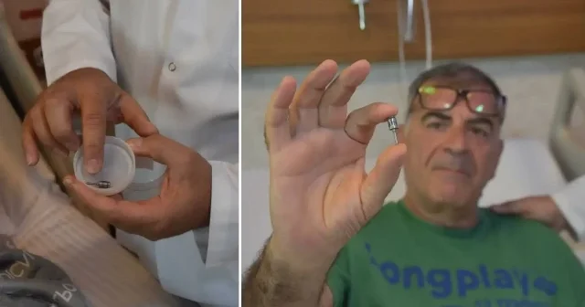 Öksürük şikayetiyle gitti: Akciğerinden diş implantı çıktı Sağlık Haberleri