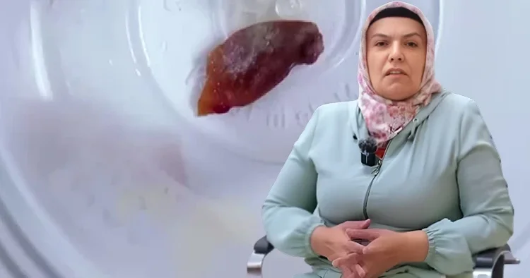 1 buçuk yıldır öksürüyordu, hastanedeki kontrolde şoke eden gerçek ortaya çıktı