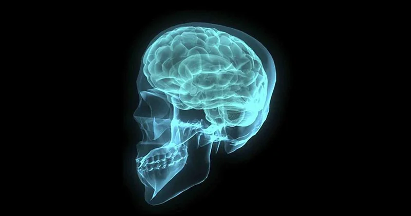 Bilim dünyasında en genç alzheimer vakası şoku