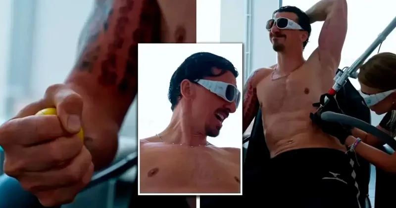 Zlatan Ibrahimovic ikonik dövmesini sildirdi