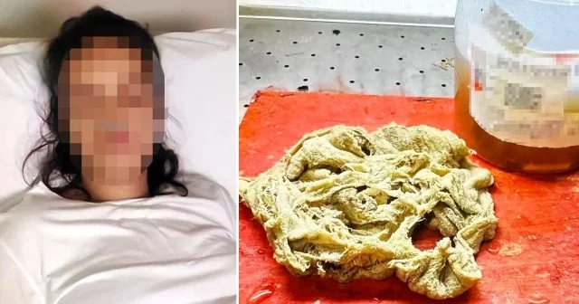 Bebeğini kucağına aldıktan sonra 2 yıl boyunca ağrıları geçmedi: 30 santimetrelik bezin karnında unutulduğu ortaya çıktı Aktüel Haberleri