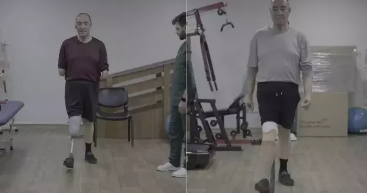 Üç uzvunu kaybetti ama pes etmedi, yeniden hayata tutundu