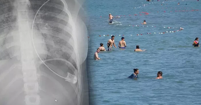 Tatil mevsimi başladı! Boğulma tehlikesi kapıda: Son 4 yılda 4 bine yakın vatandaşımızı kaybettik