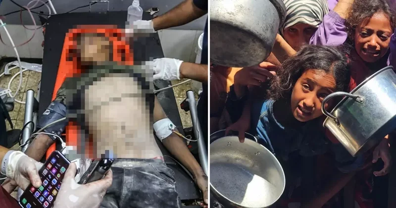 İsrail kana doymuyor! Gazze saldırılarında son 24 saatte 89 can kaybı