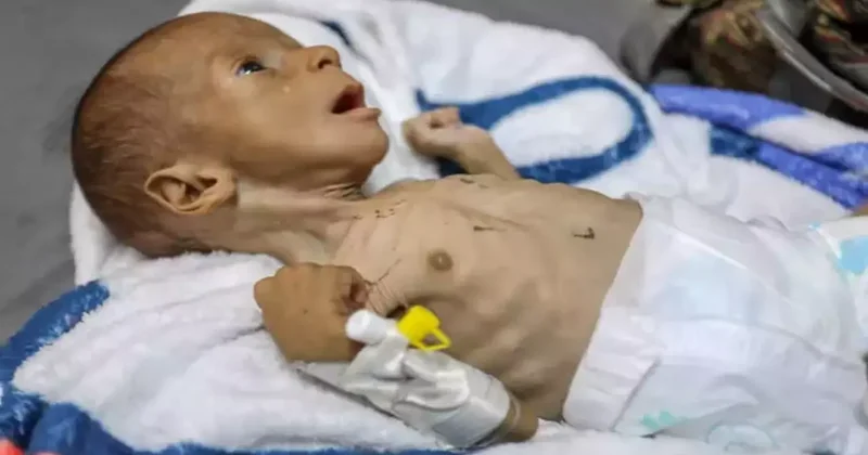 Dünyanın göz yumduğu kare! 2 aylık bebek yürekleri dağladı