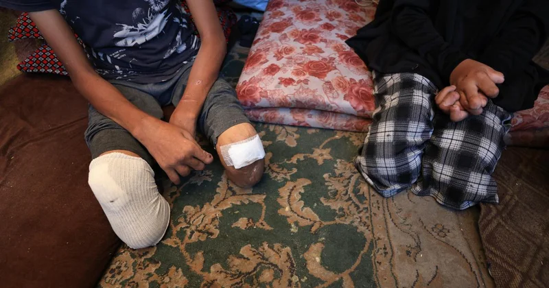 BM Komiseri: 7 Ekim den bu yana Gazze de 4 bin çocuk ampute edildi