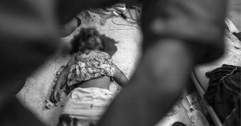 Katil İsrail’in saldırıları Gazze’de hastaneleri çökertti: Doktorlar ameliyatları anestezisiz yapıyor