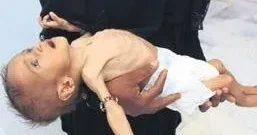 YÜKSEL AYTUĞ Çocuklar ölüyor ayağa kalk insanlık!