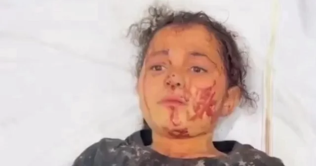 İsrail saldırısından yaralı kurtulan Gazzeli kızın feryadı: Artık savaş bitsin VİDEO İZLE