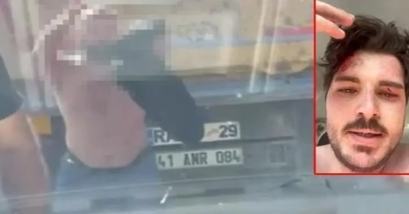 Genç oyuncuya trafikte dehşeti yaşattılar! O anları ilk kez anlattı