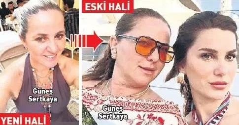 BÜLENT CANKURT Estetikli kayınvalide ortaya çıktı 10 yaş gençleşmiş