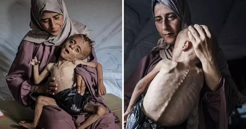 Bez yerine plastik poşet sarılmış açlıktan ölmek üzere olan çocuğun yürek burkan hikayesi