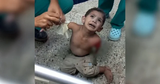 Katil İsrail in saldırısında kahreden görüntü: Bombaların şiddetiyle Gazzeli küçük çocuğun kolu koptu VİDEO İZLE