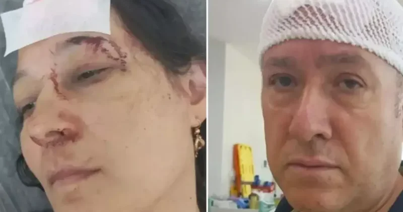 Tatilde kabusu yaşadılar! Demir sopalarla dövülüp hastanelik oldular