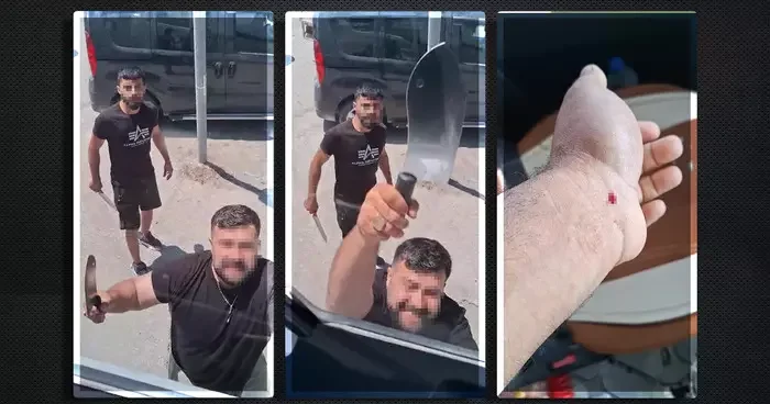 Yer: Hatay! Yol verme kavgasında satırla saldırdı... Öldüremeyince yaraladı!