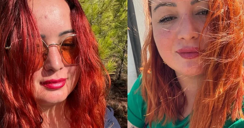 Motosikletiyle kaza yapan Merve Sönmez den acı haber geldi Sözcü Gazetesi