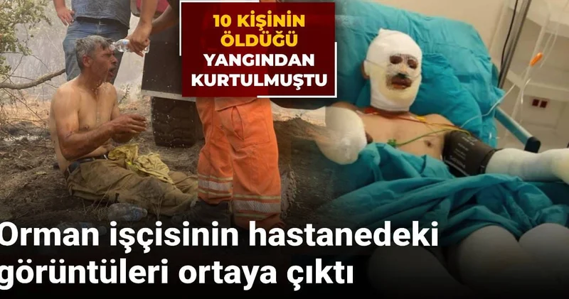 10 kişinin öldüğü yangından kurtulmuştu: Orman işçisinin hastanedeki görüntüleri ortaya çıktı