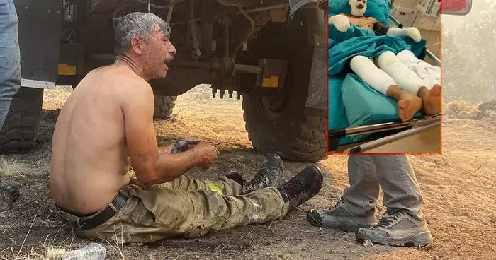 Yanıyorum diye feryat etmişti! Orman yangınına ağır yaralanan işçinin son hali ortaya çıktı