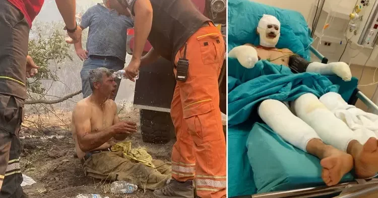 Yanıyorum, su verin feryatlarıyla yürekleri dağlamıştı! Orman işçisi Kader Dereli nin son hali paylaşıldı