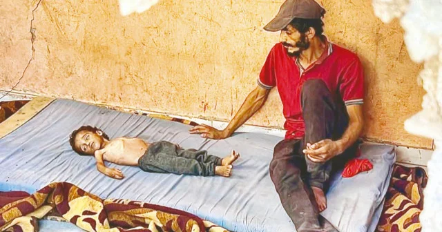 Gazze de çocuklar açlıktan ölüyor: Kopsun kıyamet Dünya Haberleri