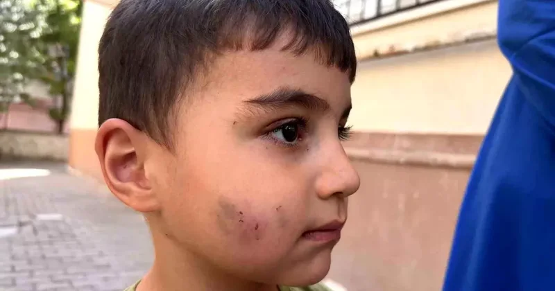 Sincan da Lağım Faresi Çocuğu Isırdı, Kuduz Aşısı Yapıldı