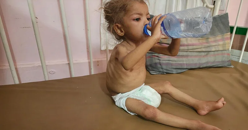 AB Gazze de açlığın savaş silahı olarak kullanılmasının ahlaka aykırı olduğunu belirtti