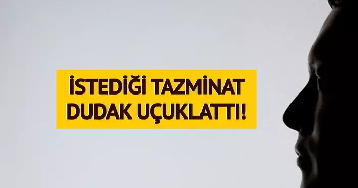 Robot tarafından bayıltıldım dedi! Talep ettiği tazminat dudak uçuklattı