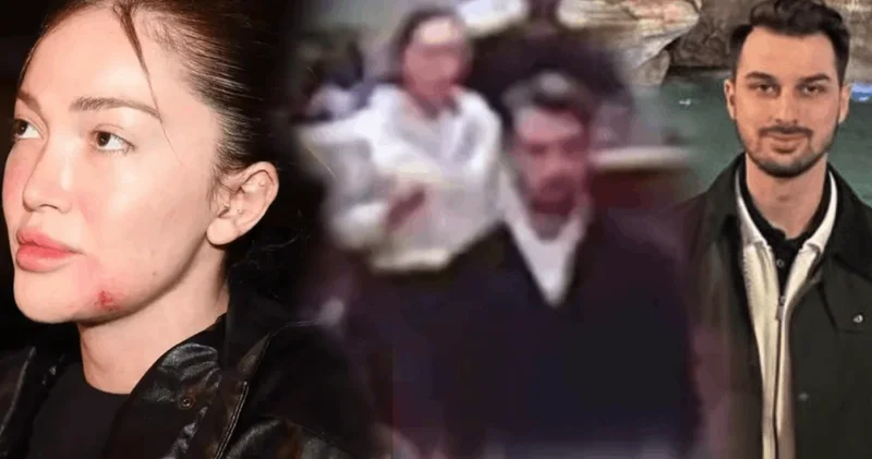 Danla Bilic’e şiddet uygulayan Berk Çetin’i bakın kim ihbar etti!