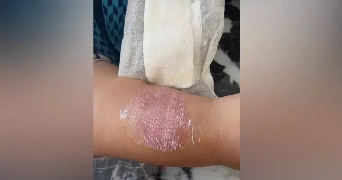 Büyükçekmece de yok artık dedirten olay! Sigara dumanı tartışmasında kolunu ısırdı