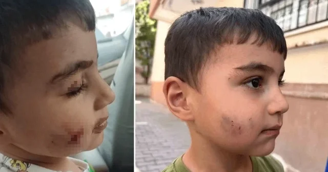 Uyurken dehşeti yaşadı: Lağım faresi ısıran çocuğa kuduz aşısı yapıldı Ankara Haberleri
