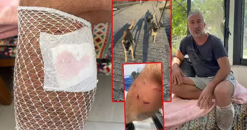 Yürüyüş yaparken köpek saldırısında yaralandı
