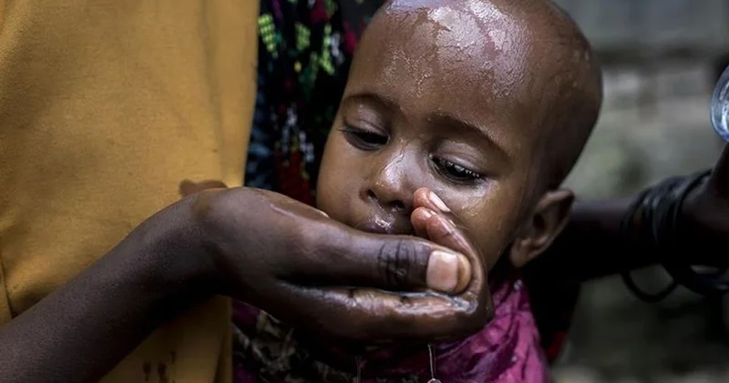UNICEF acı tabloyu açıkladı: 1 milyondan fazla çocuk kolera riski altında