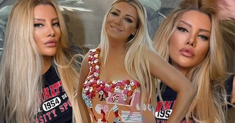 Sevenleri tanımakta zorlandı! Estetik operasyonundan 13 gün sonra...