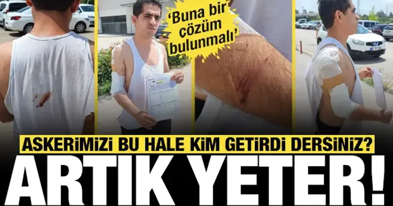 Adana’da memleketine izinli gelen asker kurt köpeğinin saldırısına uğradı