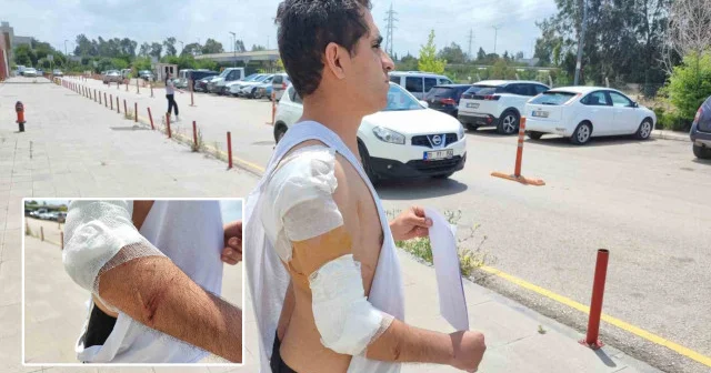 Hastane yolunda sahipsiz köpek saldırdı Adana Haberleri