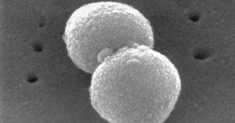 Süper bakteriye karşı geliştirilen antibiyotik, testlerin son aşamasına girdi