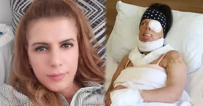Eski sevgiliden uykuda kezzap vahşeti: Kıkırdakları eridi, gözü aktı! Her satırı korkunç