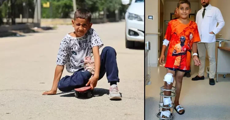 7 yıldır hayatını kaykay üzerinde sürdürüyordu! Serdal artık yürüyebiliyor! En büyük hayalini açıkladı