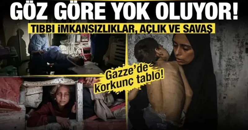 Tıbbı imkansızlıklar, açlık ve savaş... Gazze göz göre göre yok oluyor!