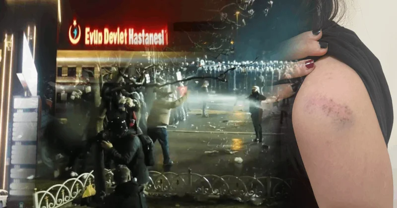 Devlet hastanesinden kırık burna sağlam raporu! Sözcü Gazetesi