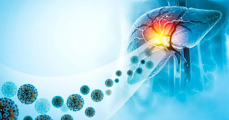 Karaciğerin sessiz düşmanı: Hepatit