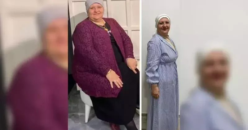 54 yaşındaki Hatice Yıldırım, 1 yılda 35 kilo verdi