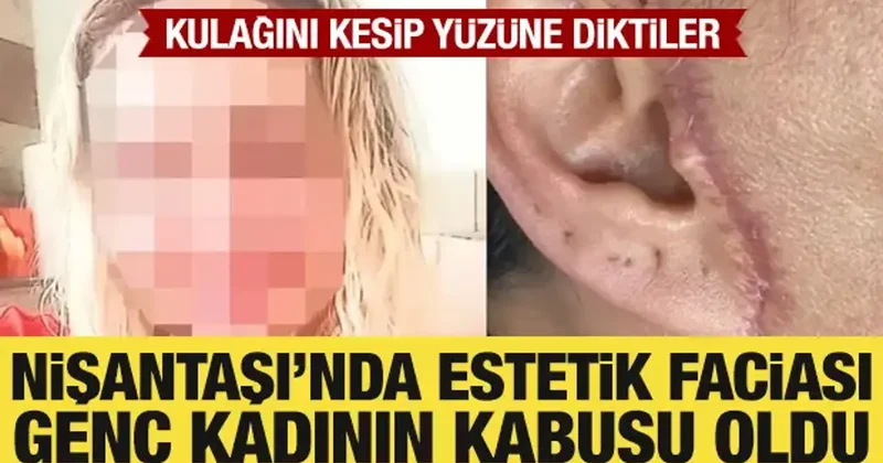 Estetik ameliyatı genç kadının kabusu oldu: Kulağını kesip yüzüne diktiler
