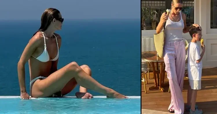 Dünyaca ünlü model Antalya nın güneşinde yandı!