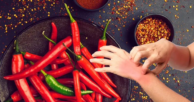 Eldeki biber yanmasına ne iyi gelir? Elde kalan biber acısını geçirmenin pratik yolu