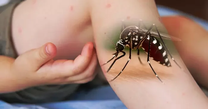 Küresel salgın uyarısı! DSÖ tüm ülkeleri uyarıyor: Sivrisinekler yolu ile bulaşan chikungunya virüsü tehlikesi! Türkiye de chikungunya virüsü görülüyor mu?